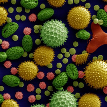 Pollen grains visualized under a scanning electron microscope